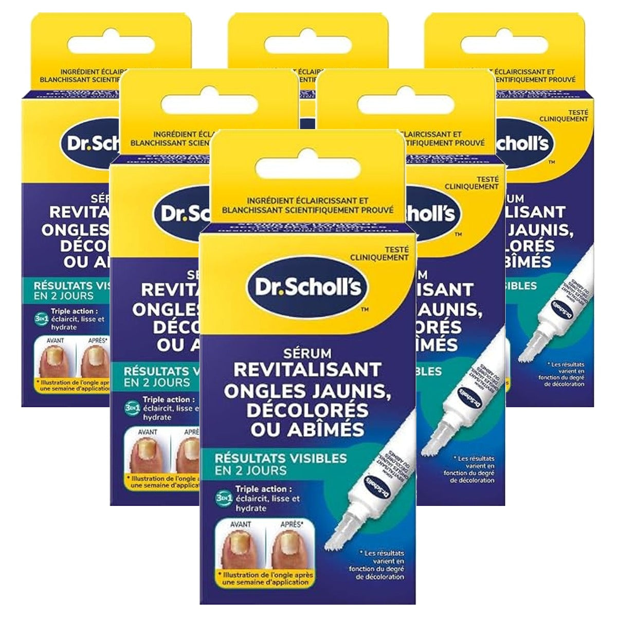 Dr. Scholl's Revitaliserend Serum voor Vergeelde Nagels 6 x 10 ml - Voordeelverpakking
