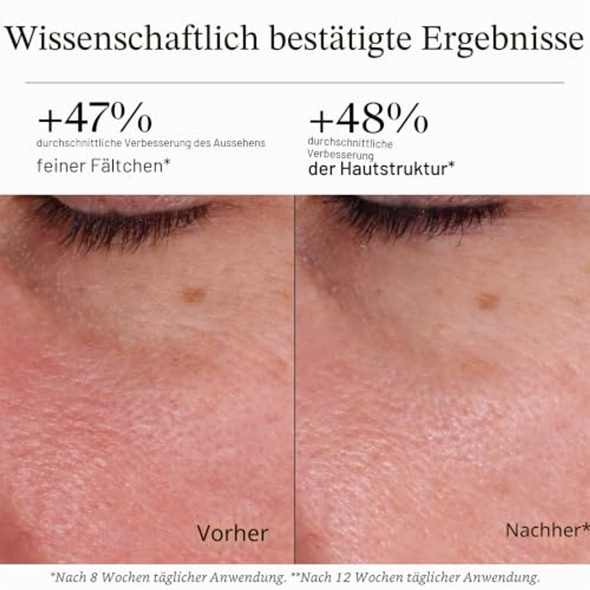 Neutrogena Retinol Boost Day Cream SPF15 6 x 50 ml - Voordeelverpakking