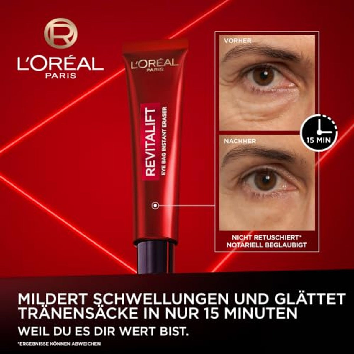 L'Oréal Paris Revitalift Laser Anti-Eye Bag 3 x 15 ml - Voordeelverpakking