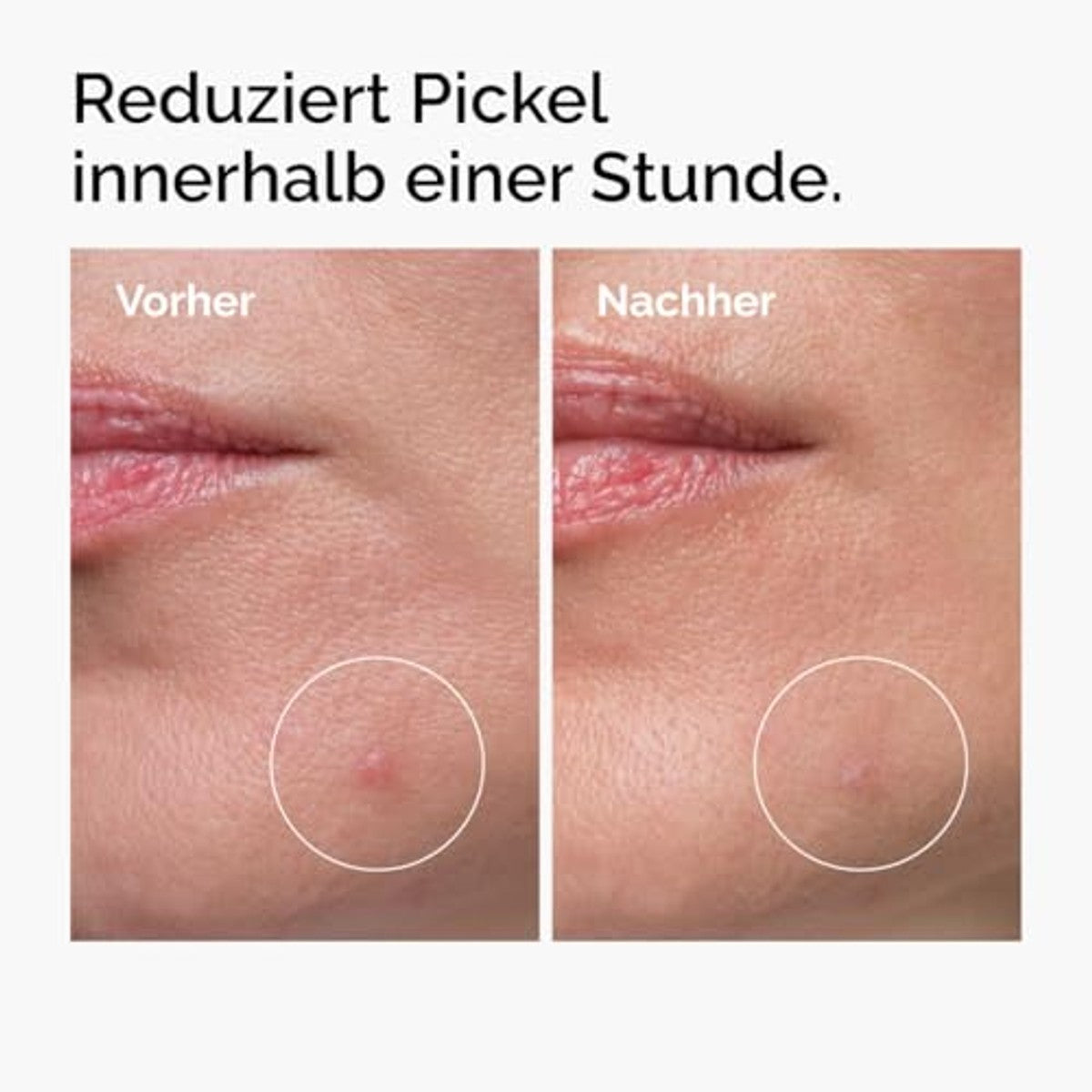 The Ordinary Sulfur Powder-to-Cream Concentrate, gerichte behandeling van onzuiverheden met zwavel, vermindert het optreden van onzuiverheden, 5 g