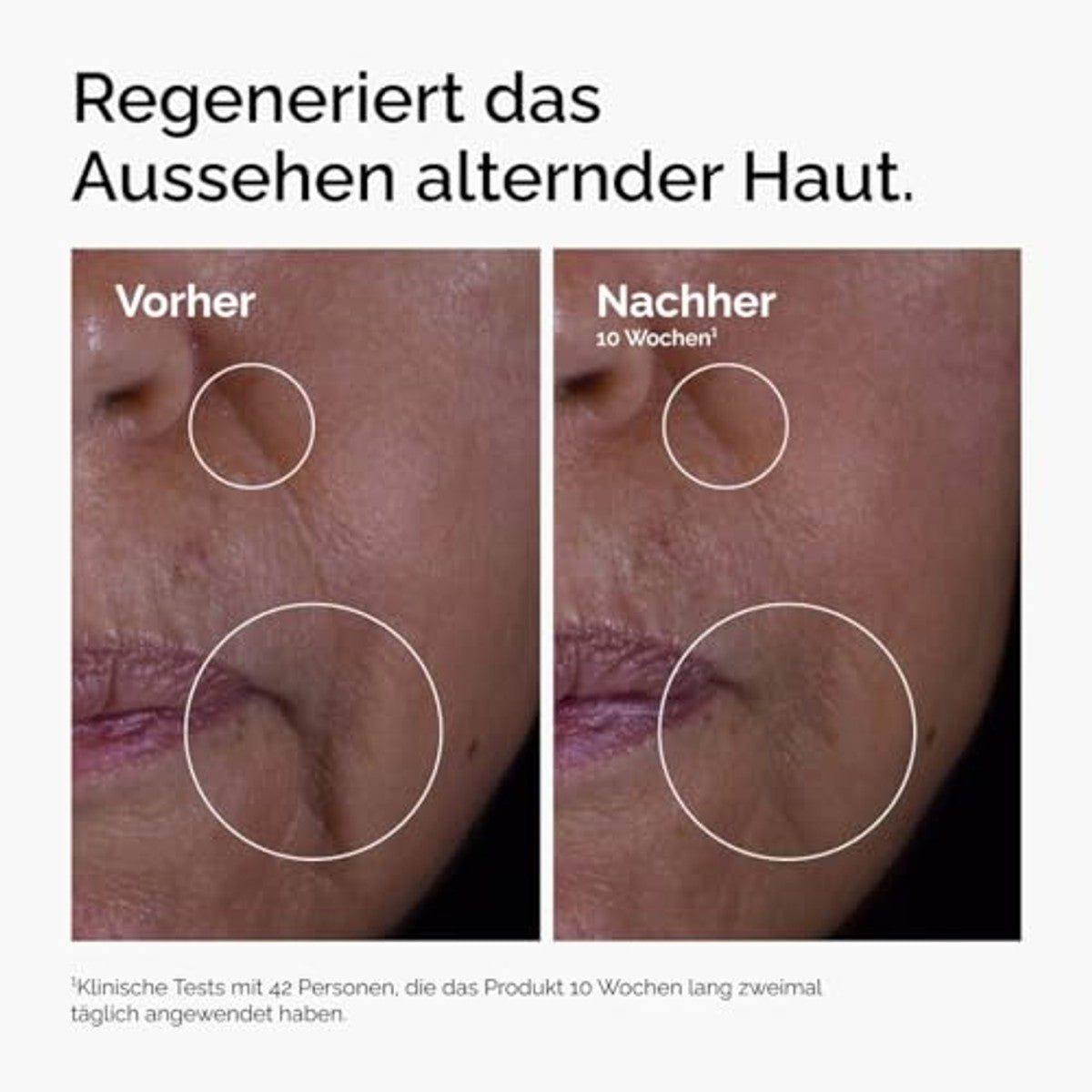 The Ordinary GF 15% oplossing, anti-aging formule voor zichtbare huid- en rimpelreparatie, 30 ml