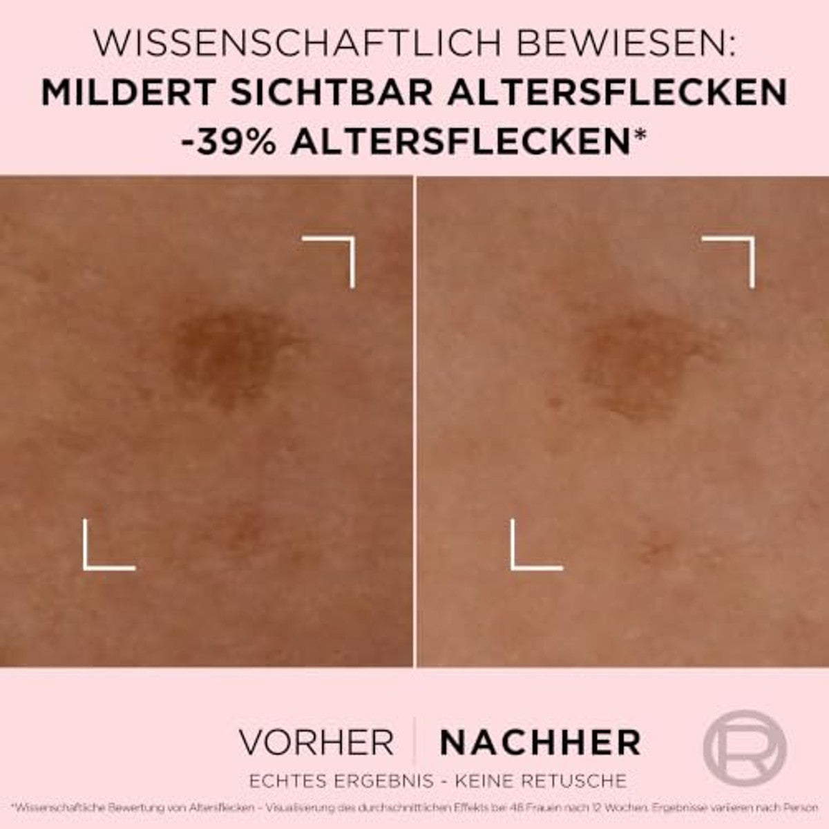 L'Oréal Paris Golden Age Rapid Corrector Serum 6 x 30 ml - Voordeelverpakking
