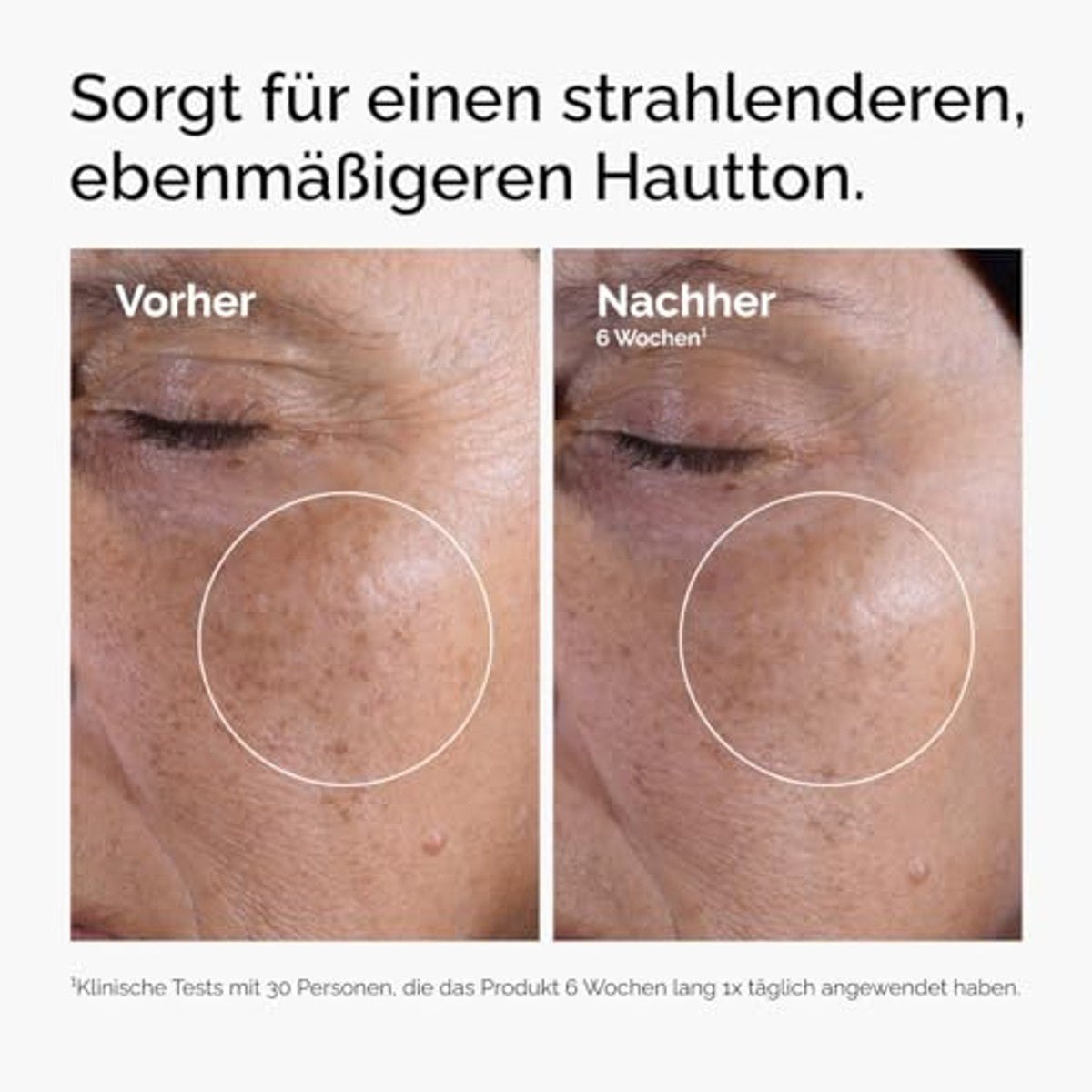 The Ordinary Glycolic Acid 7% Exfoliating Toner, Aufhellender und glättender täglicher Toner für einen gleichmäßigeren Hautton