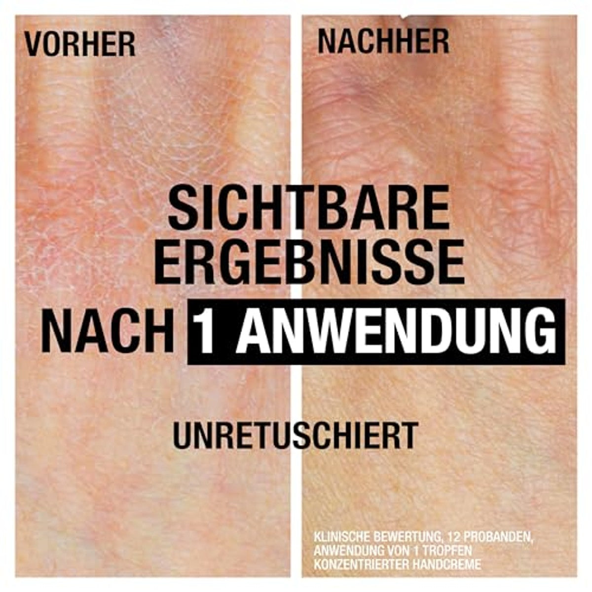 Neutrogena Geconcentreerde Handcrème Ongeparfumeerd 6 x 50 ml - Voordeelverpakking