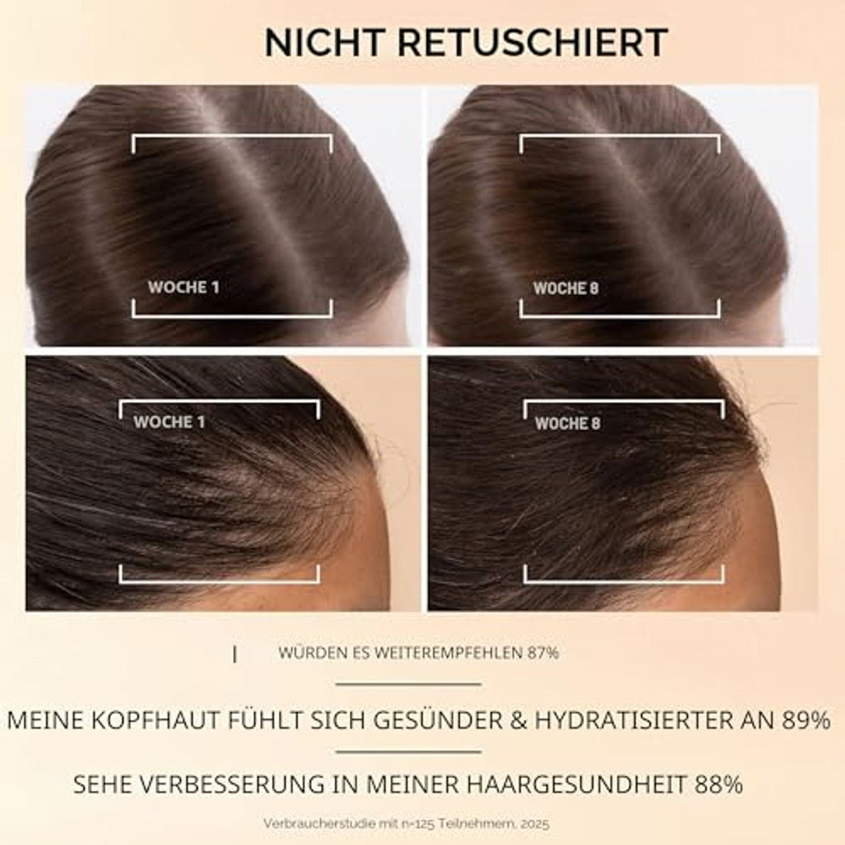 Pantene Grow Abundant Haaruitval Serum voor Dames 3 x 60 ml - Voordeelverpakking