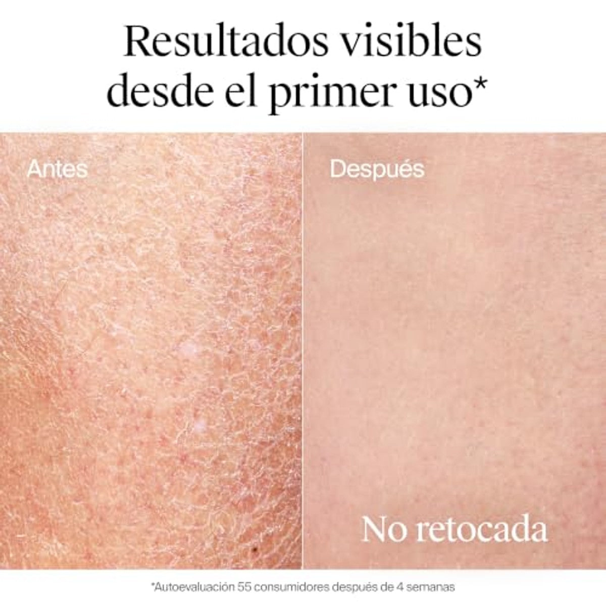 Neutrogena Oil in Lotion Diepe Hydratatie 400 ml – Neutrogena
