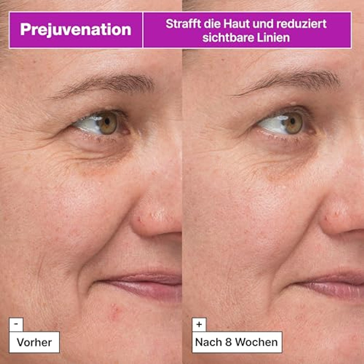 Dr.Jart+ Prejuvenation Straffende Bakuchiol-Serum 50 ml