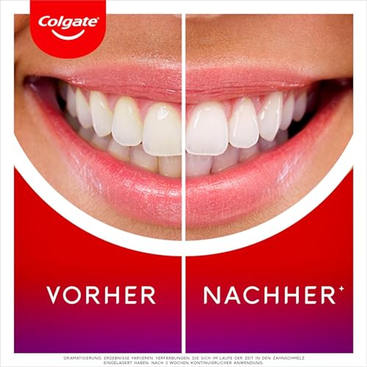 Colgate Max-witte led-whitening kit + overnight serum 2,5 ml – Colgate