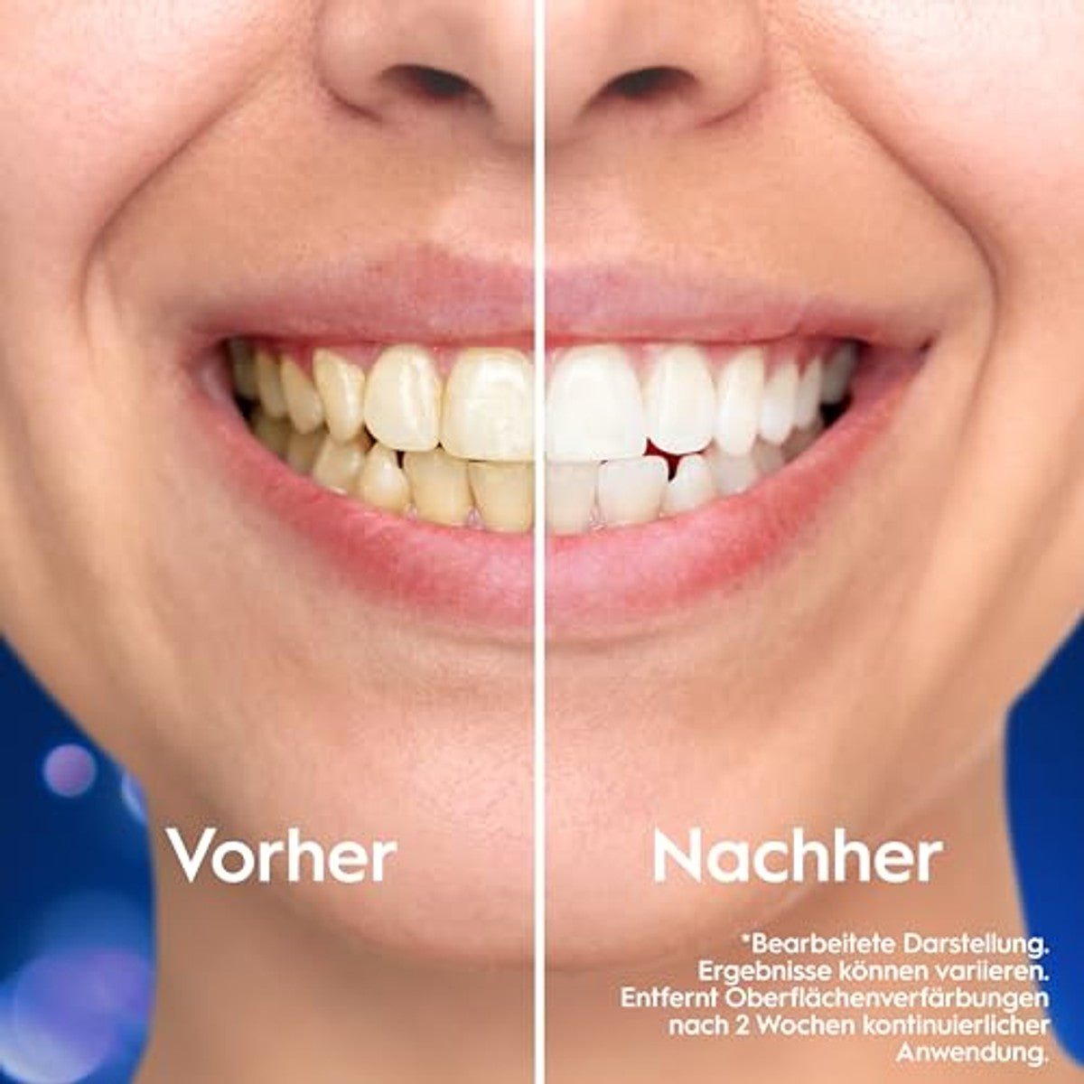 Oral-B Pro 3D White Clinical Intensieve Whitening 2 x 75 ml – Oral-B