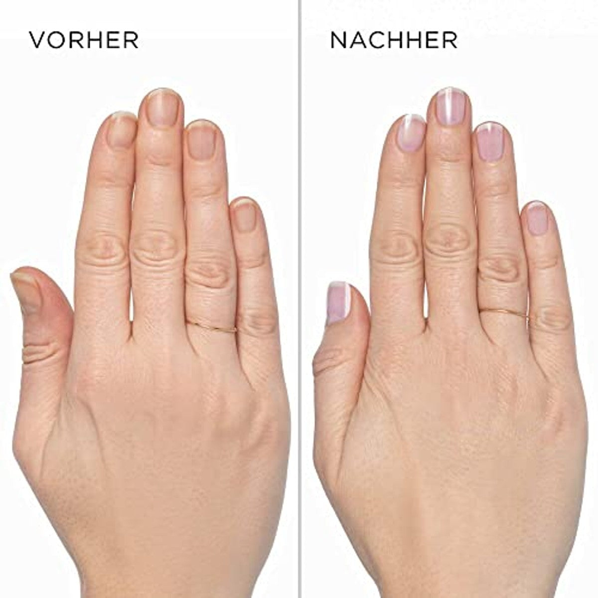 Artdeco Nail Whitener French Rose nagellak rosetint 1 x 10 ml - 6-pack