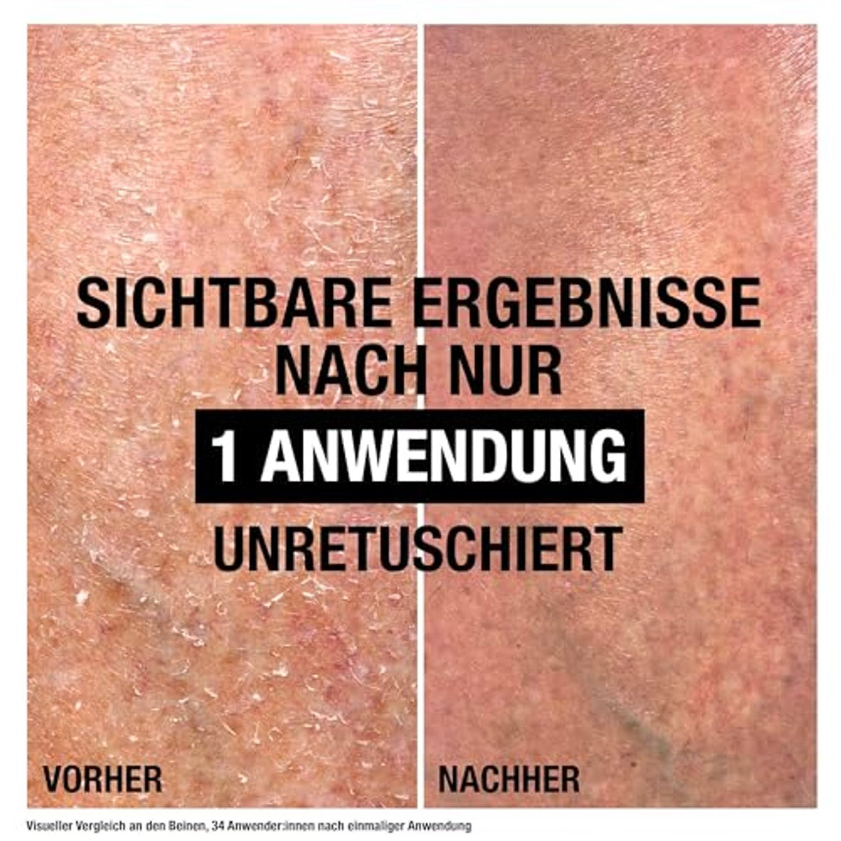 Neutrogena Intense Repair CICA bodybalsem 6 x 250 ml - Voordeelverpakking
