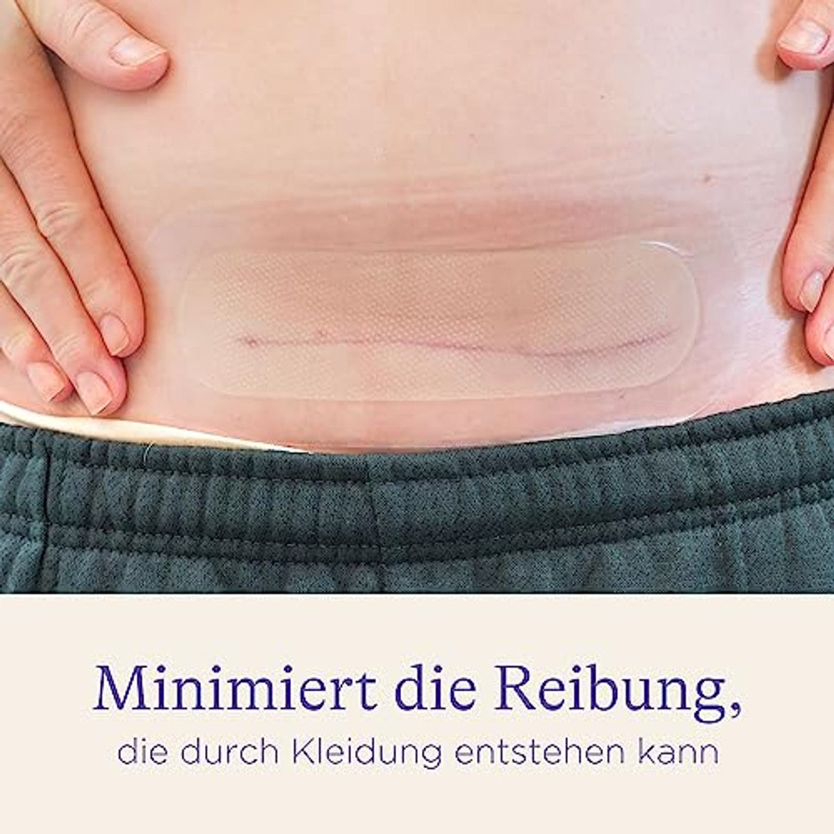 Lansinoh Keizersnede Hydrogel Pads 2 stuks - 6-pack