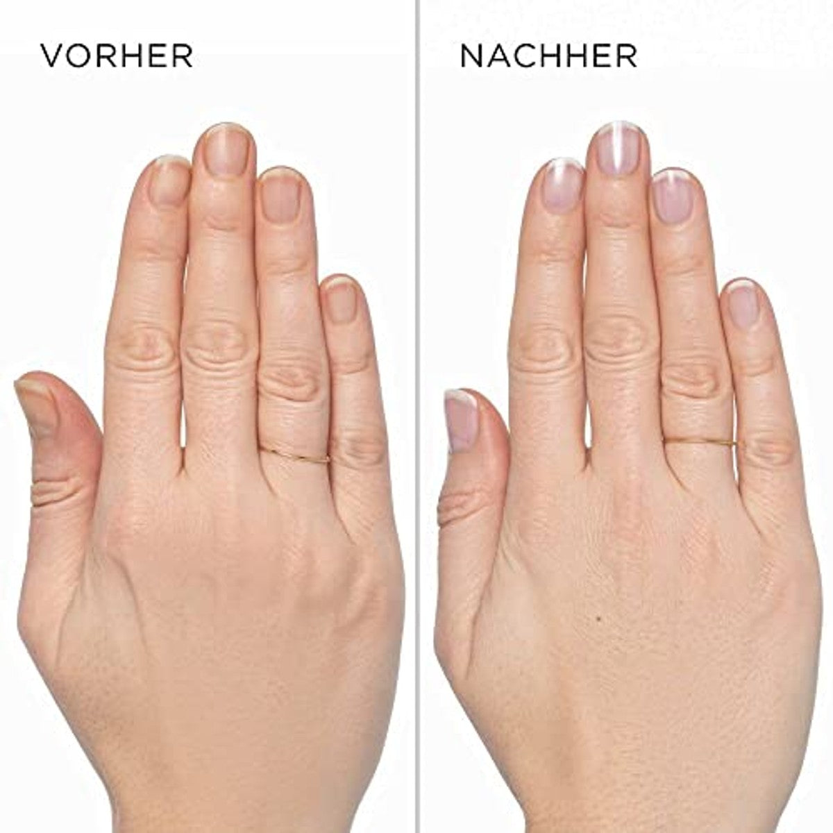 Artdeco Nail Whitener French Look 1 x 10 ml - 6-pack