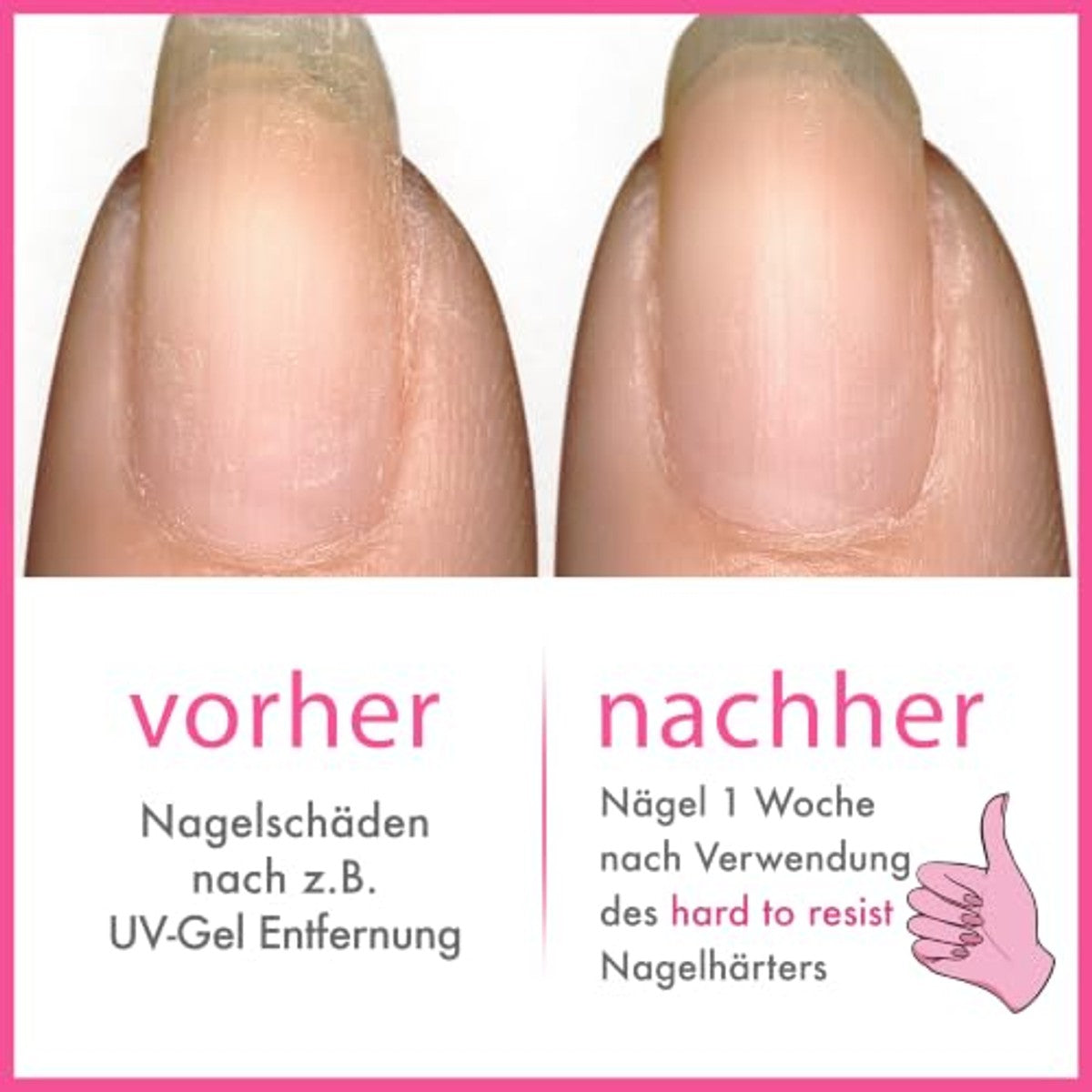 essie Nagelverharder voor natuurlijk stralende, glanzende en sterkere nagels, veganistische formule zonder ingrediënten van dierlijke oorsprong, hard to resist, roze tint, 1 x 13,5 ml | Natuurlijk stralende nagels, glanzende en sterkere – essie