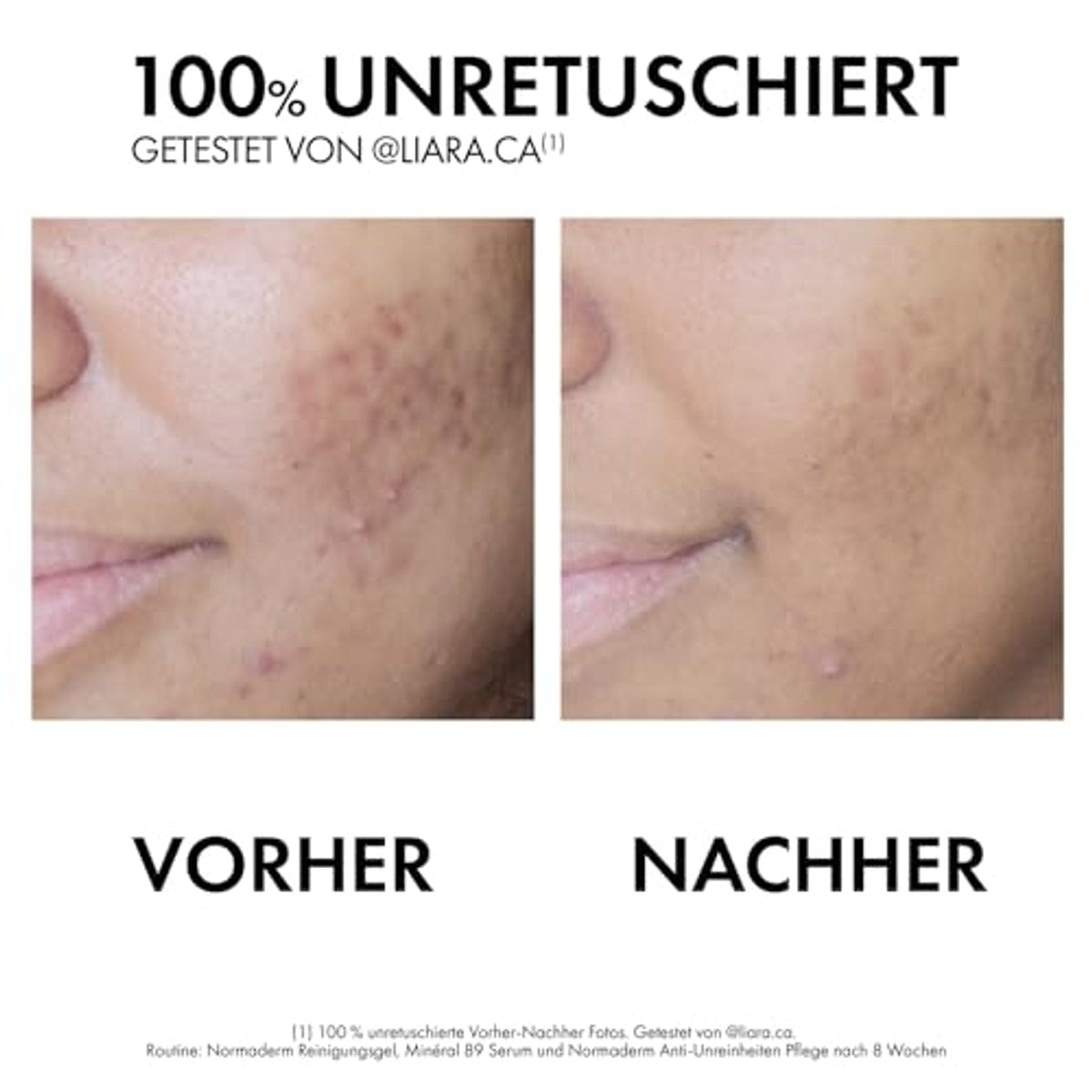 Vichy Normaderm Phytosolution Anti-onzuiverheden Verzorging 50 ml