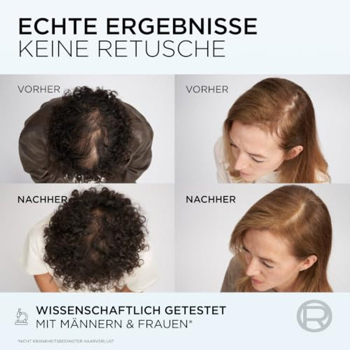 L'Oréal Paris Elvital Fiber Booster Hoofdhuidserum 3 x 102 ml - Voordeelverpakking