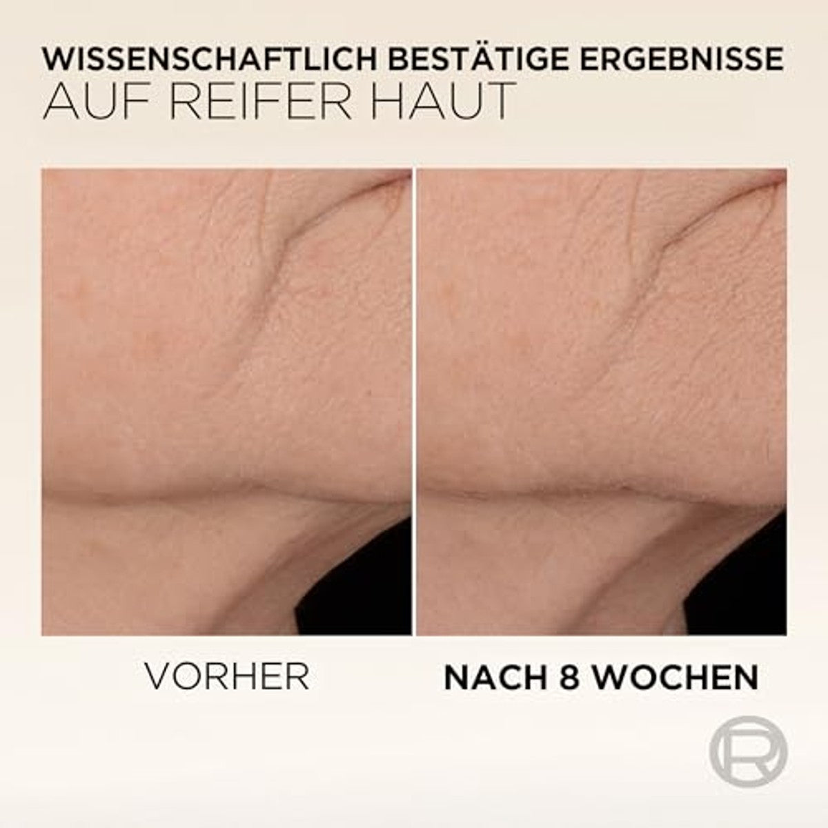 L'Oréal Paris Age Perfect Collageen Expert Serum 30 ml – L'Oréal Paris