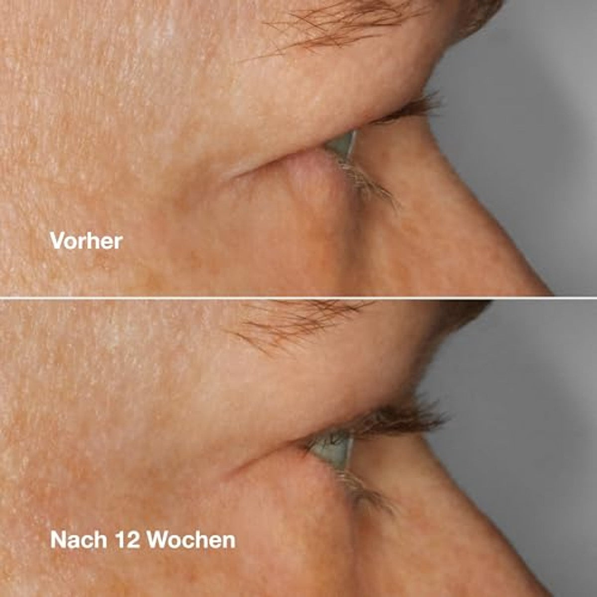 Huishoudvoordeel Clinique High Impact Lash Amplifying Serum 3 ml - 3 stuks