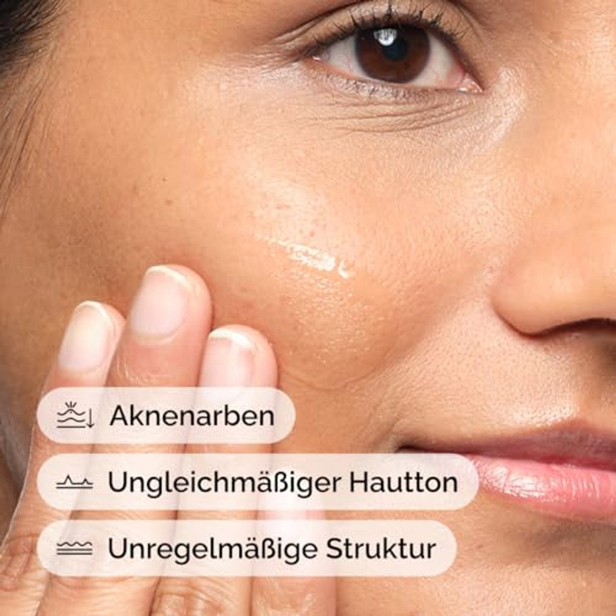 The Ordinary Aloë 2% + NAG 2% oplossing, kalmeert de huid en werkt gericht tegen acne littekens, 30 ml
