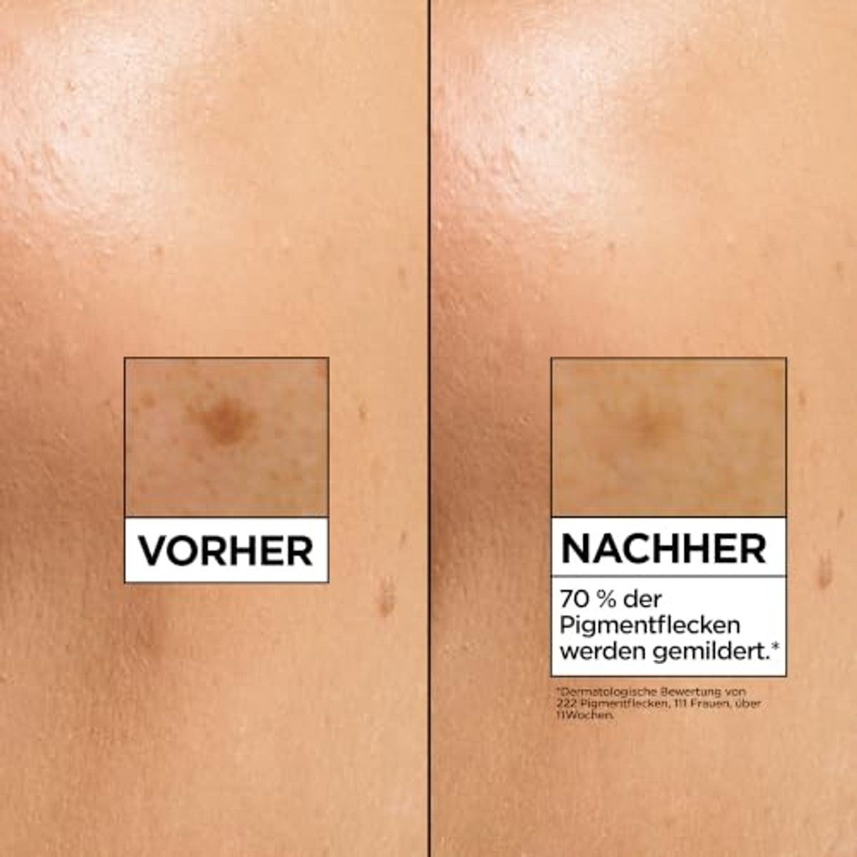 Garnier SkinActive Vitamine C Brightening Serum 30 ml – Garnier