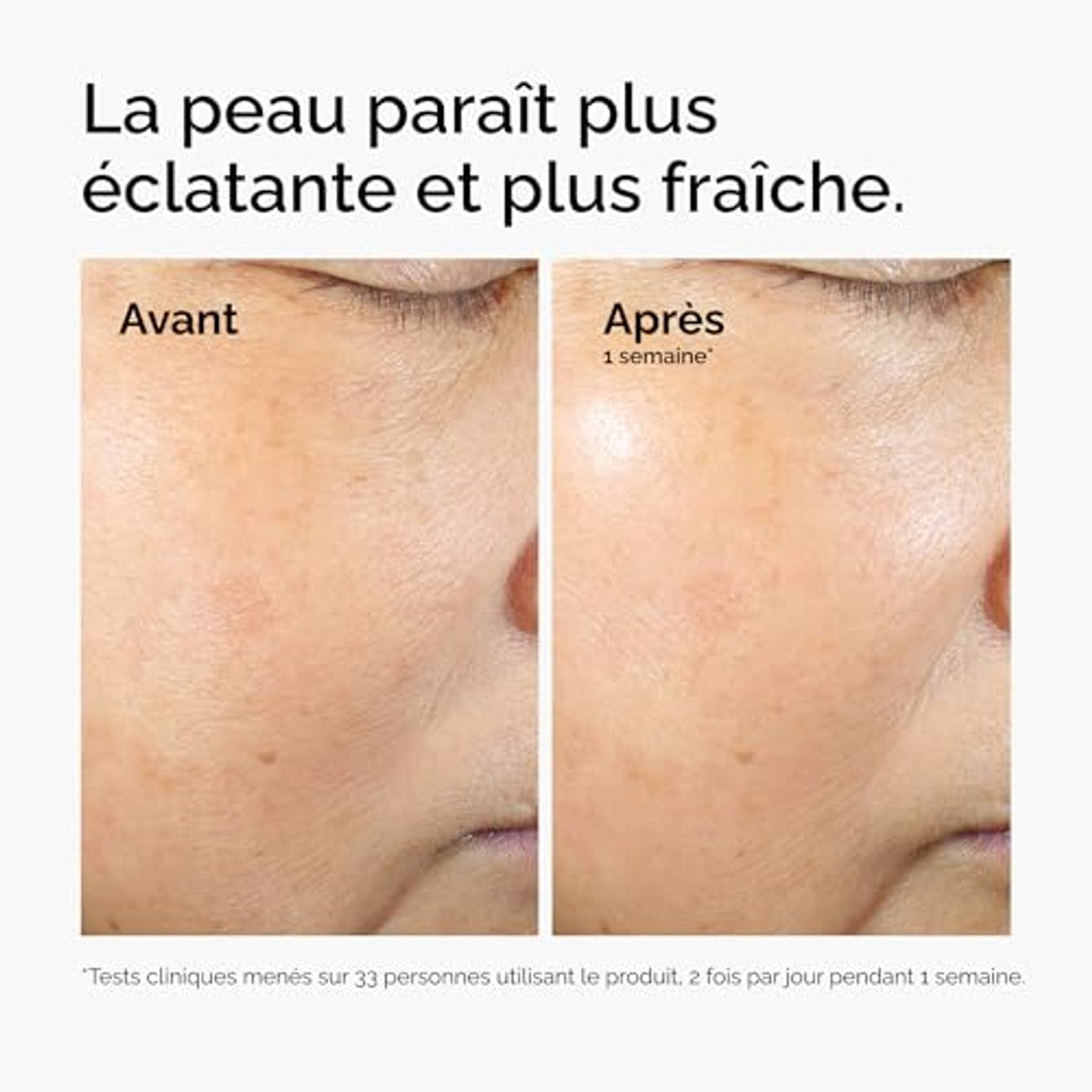The Ordinary Rice Lipids + Ectoïne Microemulsie Crème - 6-pack