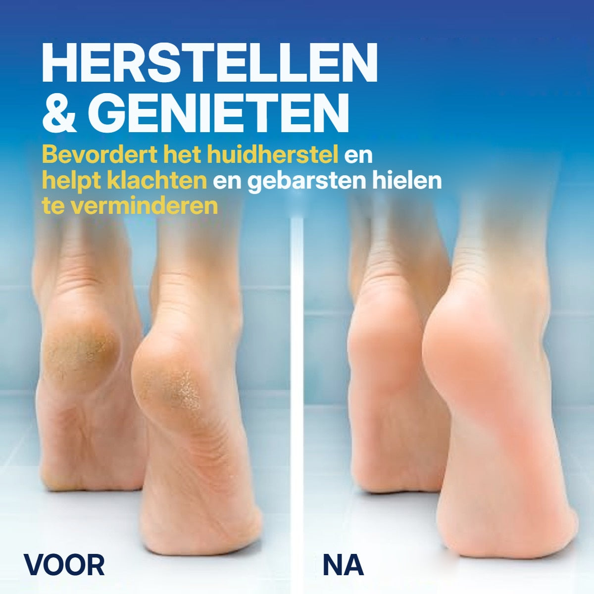 Dr. Scholl's Kloofzalf Active Repair K+ 60 ml – foto 5