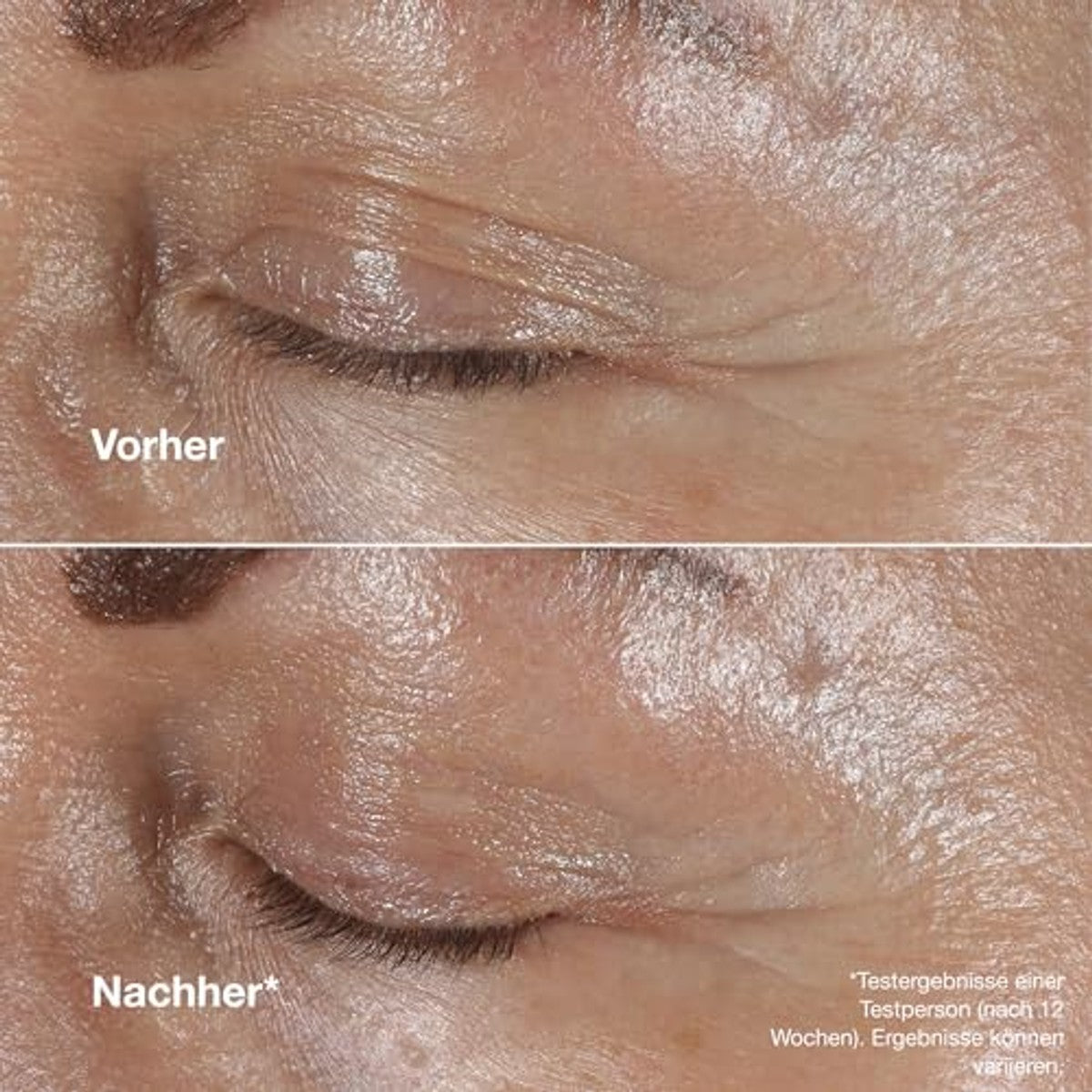 Huishoudvoordeel Clinique Smart Clinical Repair Wrinkle Correcting Eye Cream 3 stuks
