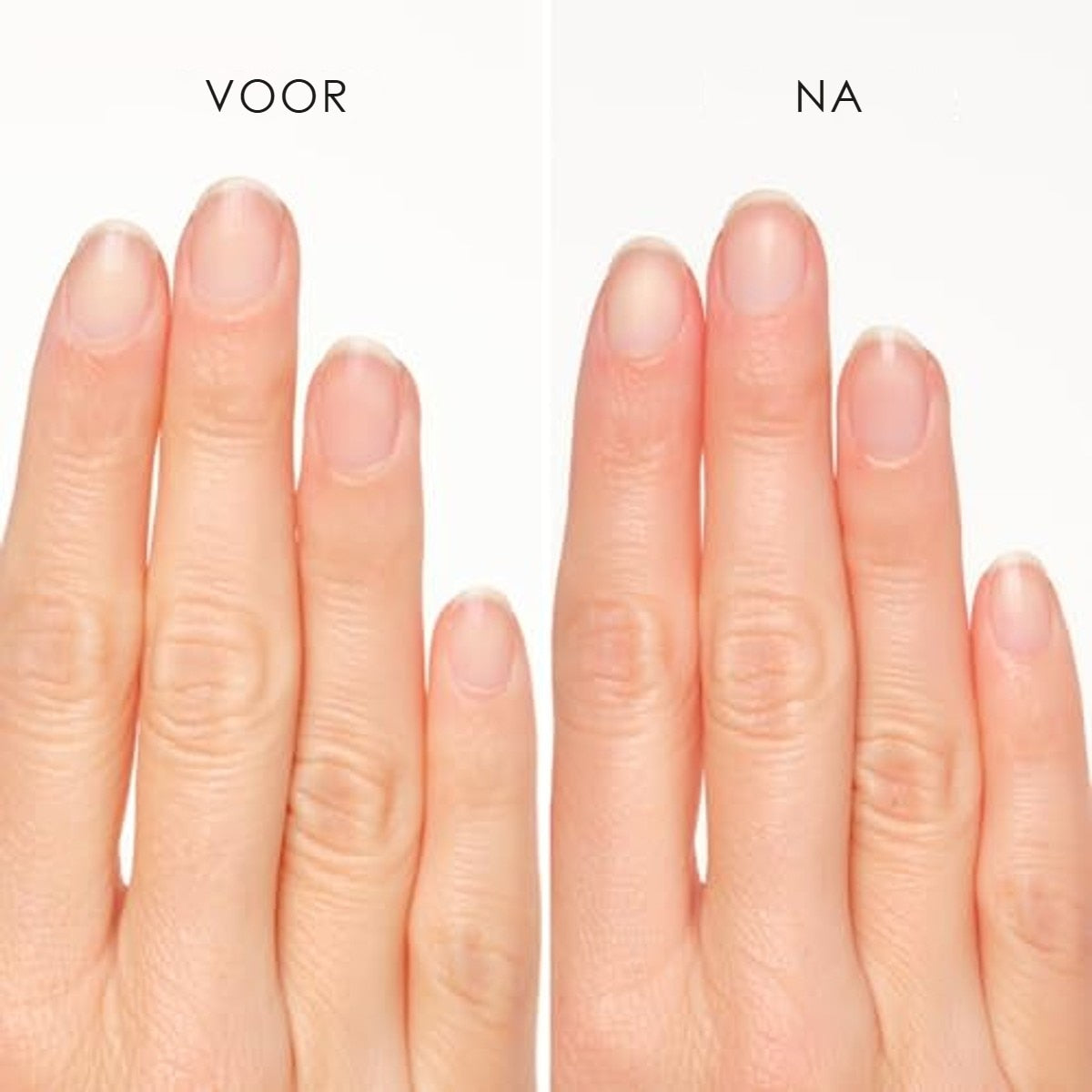 Artdeco Nagelriemverwijderaar stick 1 x 4,5 ml – foto 5