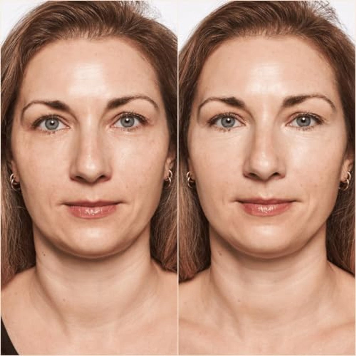 Catrice Cosmetics True Skin High Cover Concealer 002 nude 2 stuks - 3-pack