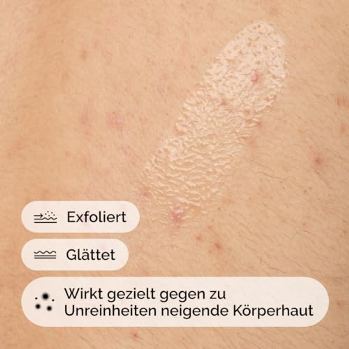 The Ordinary Salicylic Acid 0,5% Body Serum, lichaamsserum met salicylzuur, scrubbehandeling voor onzuiverheden gevoelige huid, 240 ml