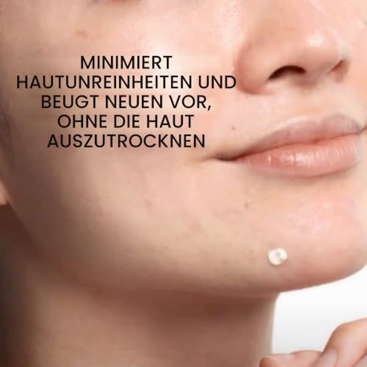 Vichy Normaderm S.O.S. Anti-Puistjes Zwavelpasta met 10% Zwavel, 20 ml - 3-pack