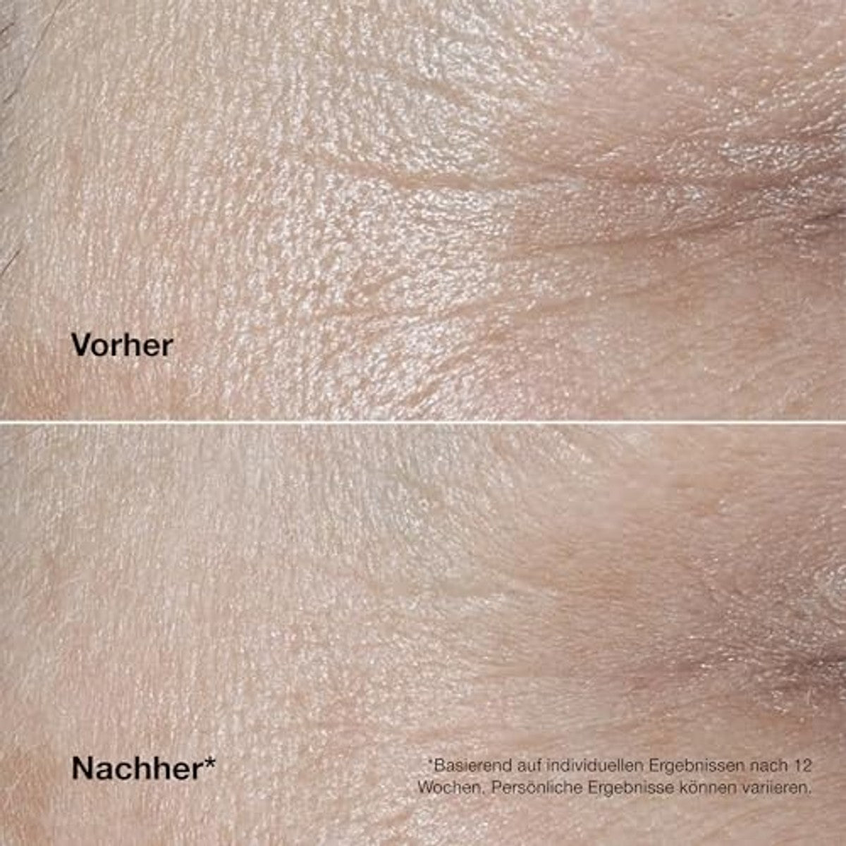 Huishoudvoordeel Clinique Smart Clinical Repair™ Cream 50 ml - 3 stuks