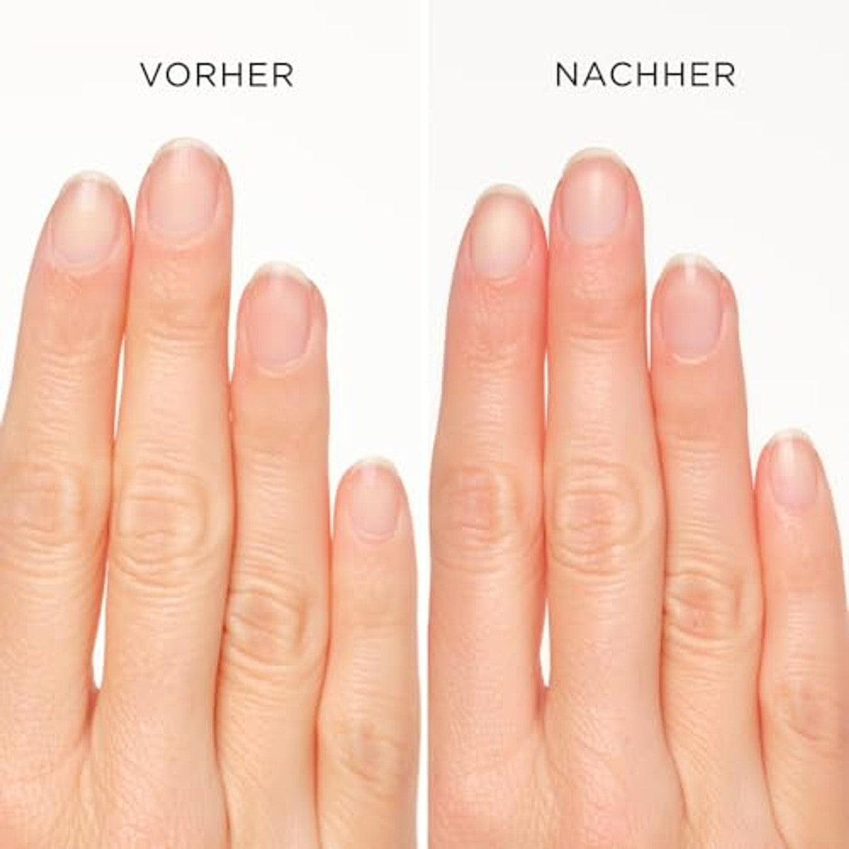 Artdeco Nagelriemverwijderaar stick 1 x 4,5 ml - 3-pack