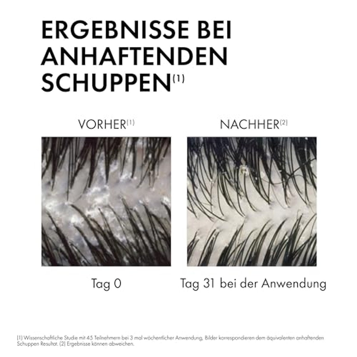 Vichy Dercos Anti-roos Verzorgende Shampoo voor Droge Hoofdhuid 200 ml - 3-pack