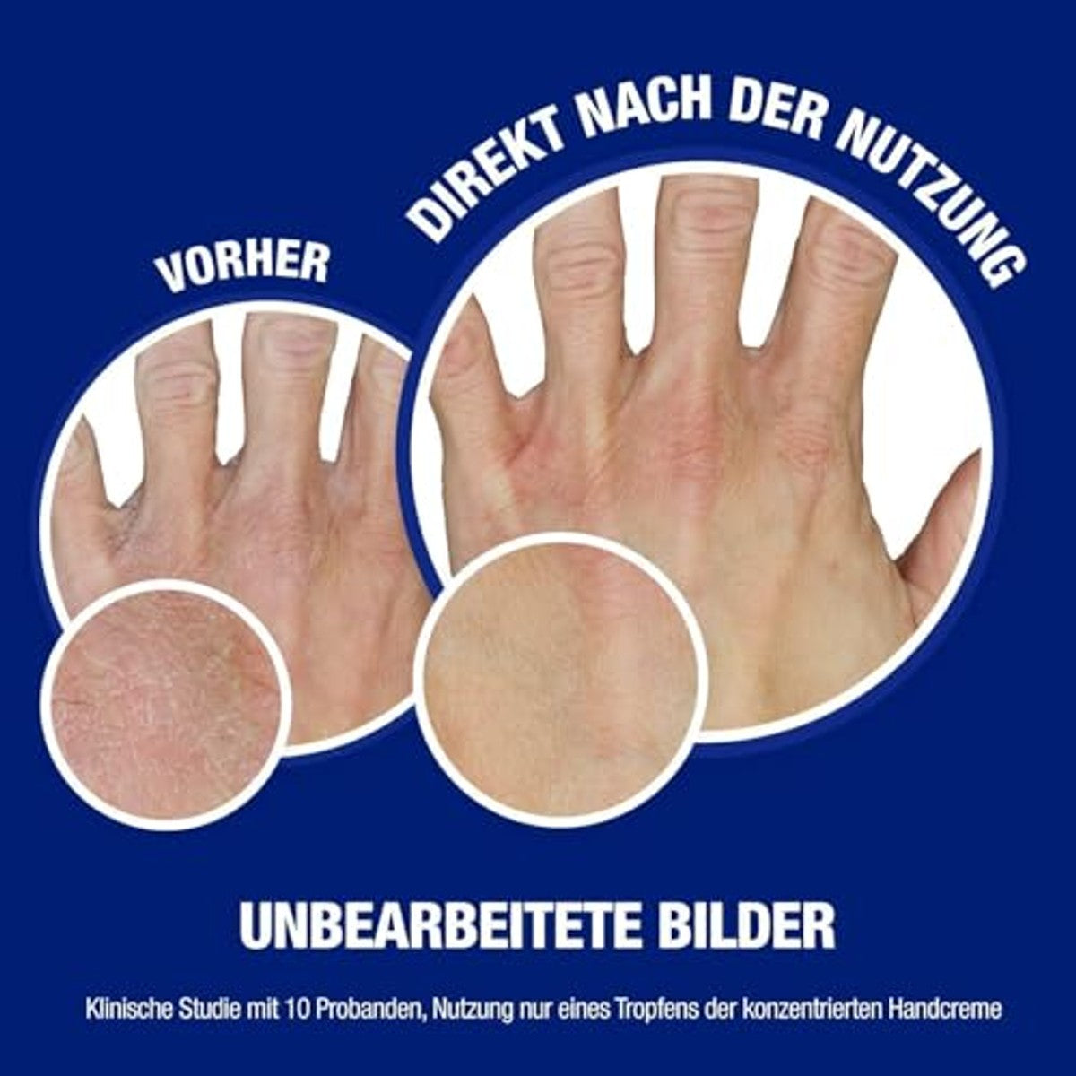 Neutrogena Onmiddellijk Intrekkende Handcrème 3 x 150 ml - Voordeelverpakking