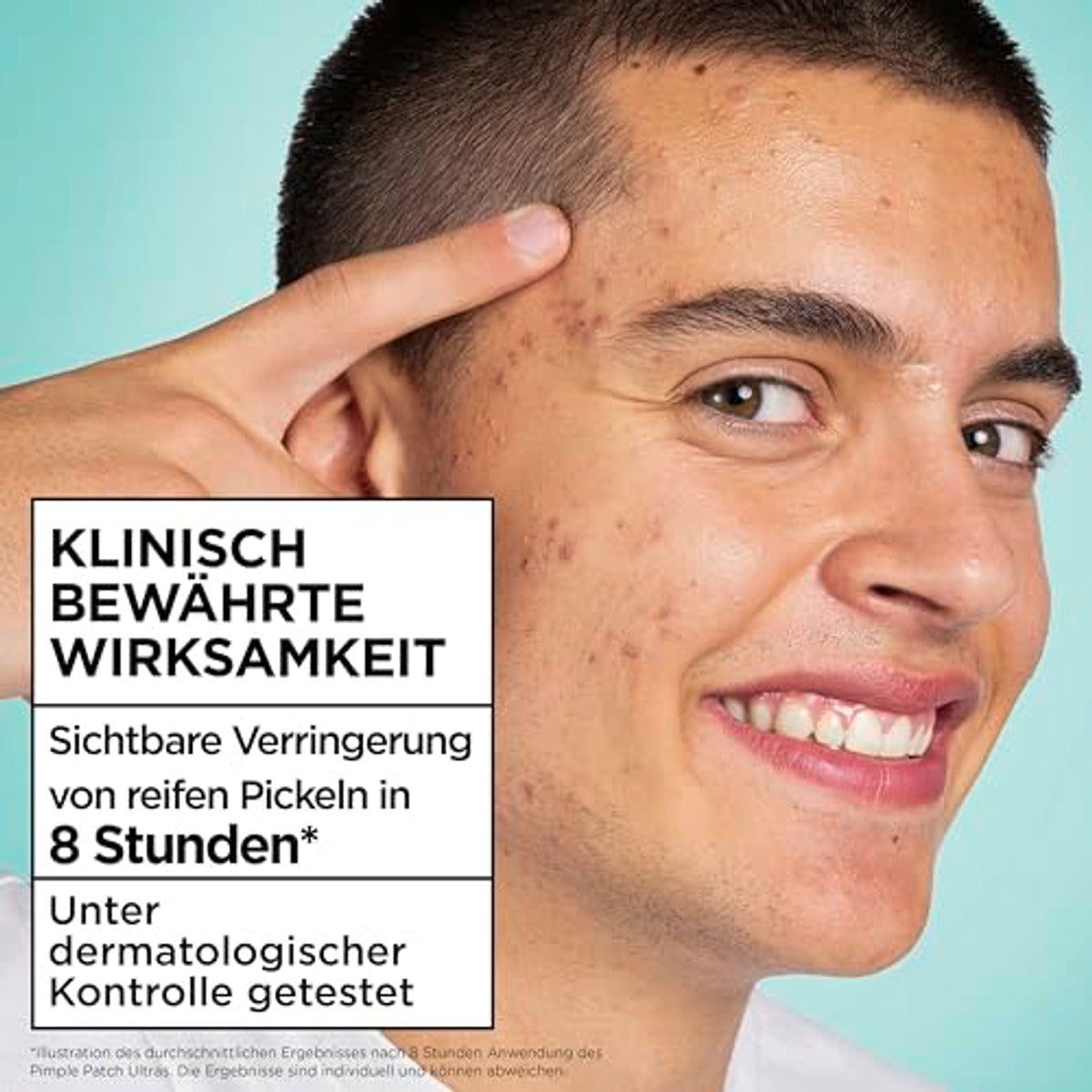 Garnier Hautklar Pimple Patches 3 x 44 stuks - Voordeelverpakking