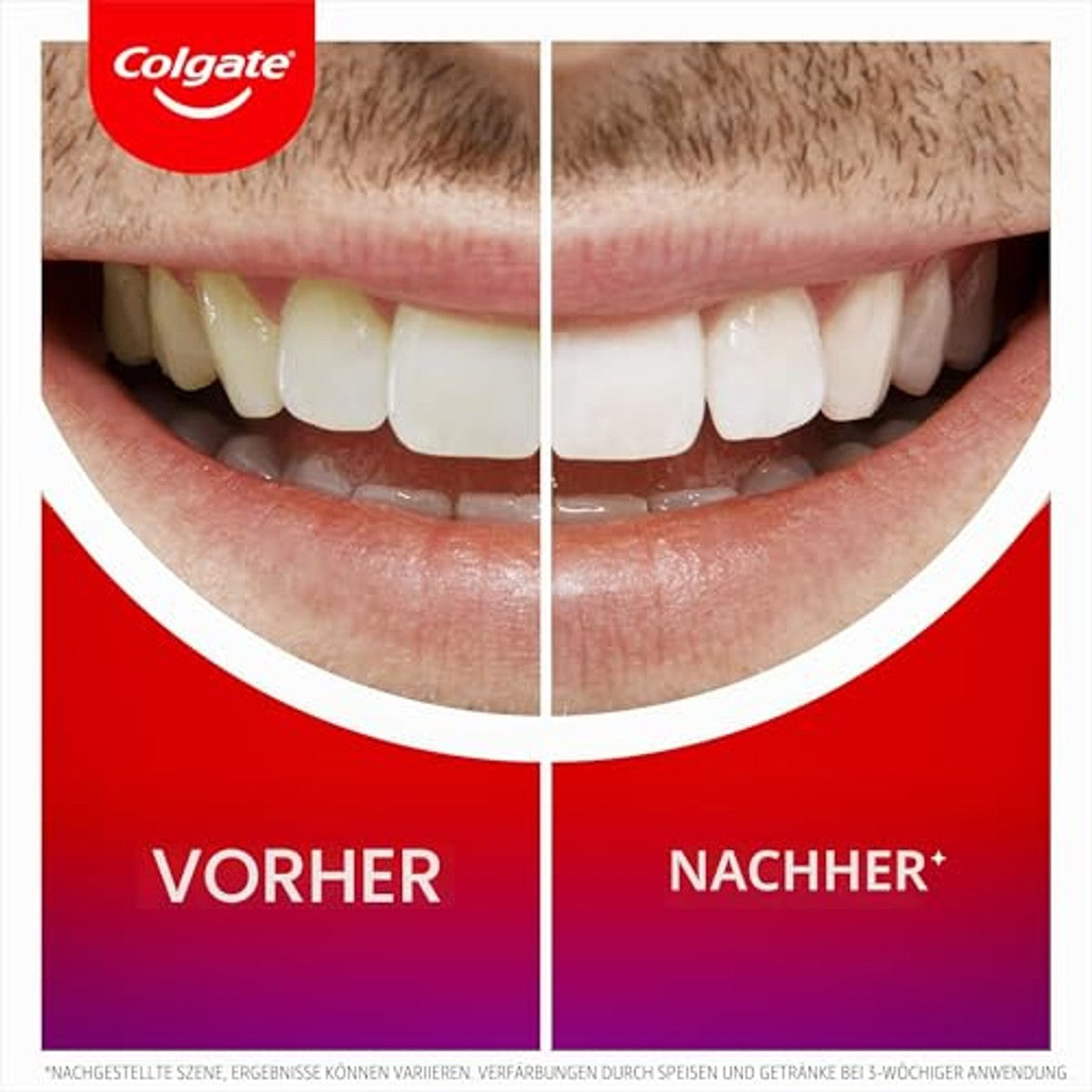 Colgate Tandbleekset 2,5 ml + 3 x 75 ml - Voordeelverpakking