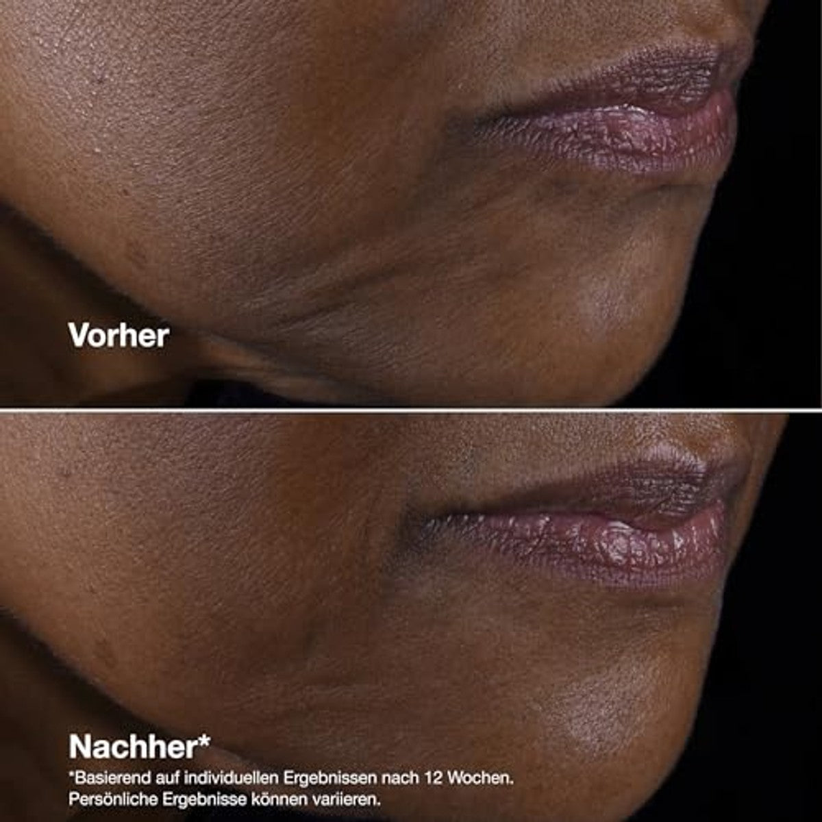Huishoudvoordeel Smart Clinical Repair Lifting Face + Neck Cream - 3 stuks