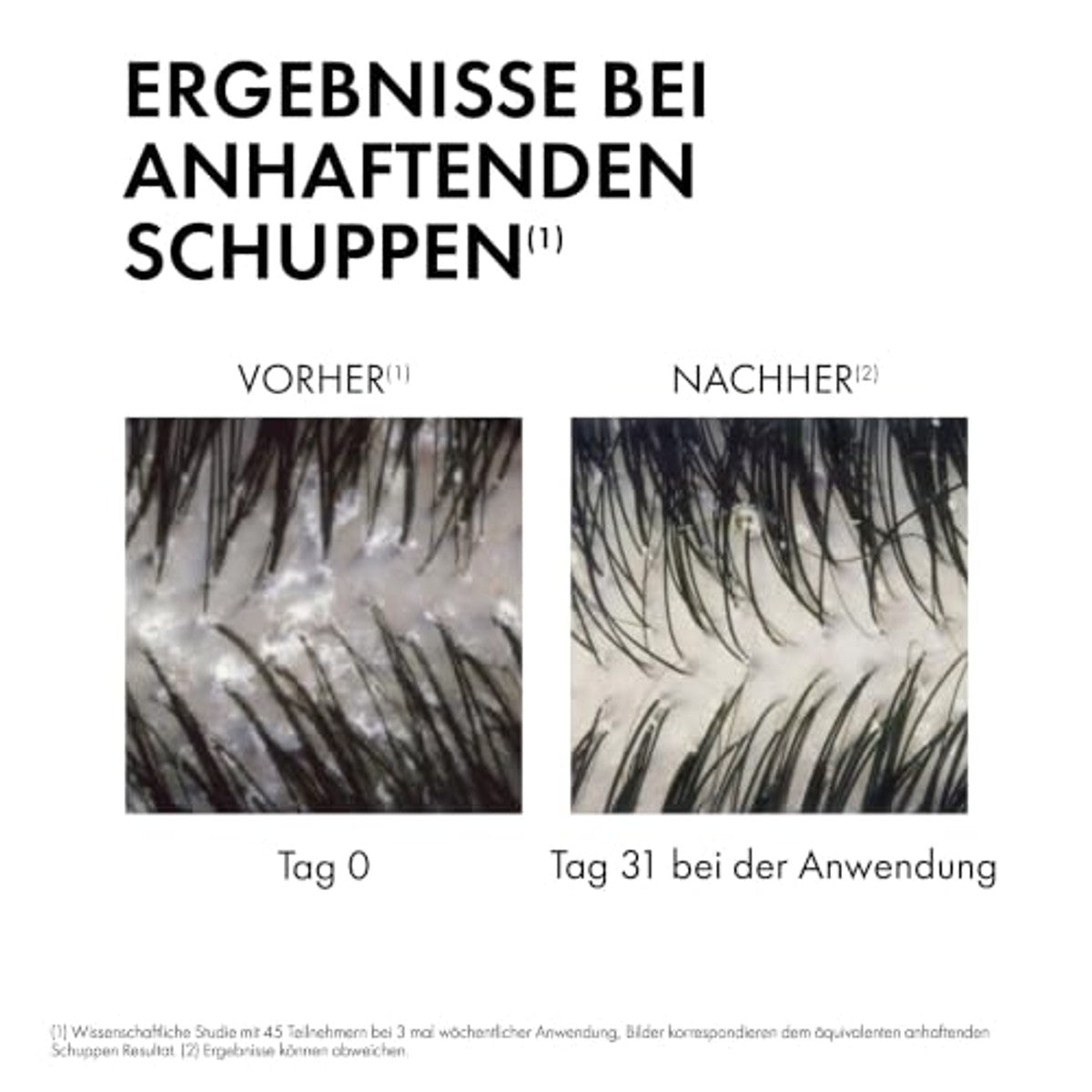 Vichy Dercos Anti-roos Verzorgende Shampoo voor Droge Hoofdhuid 390 ml - 3-pack