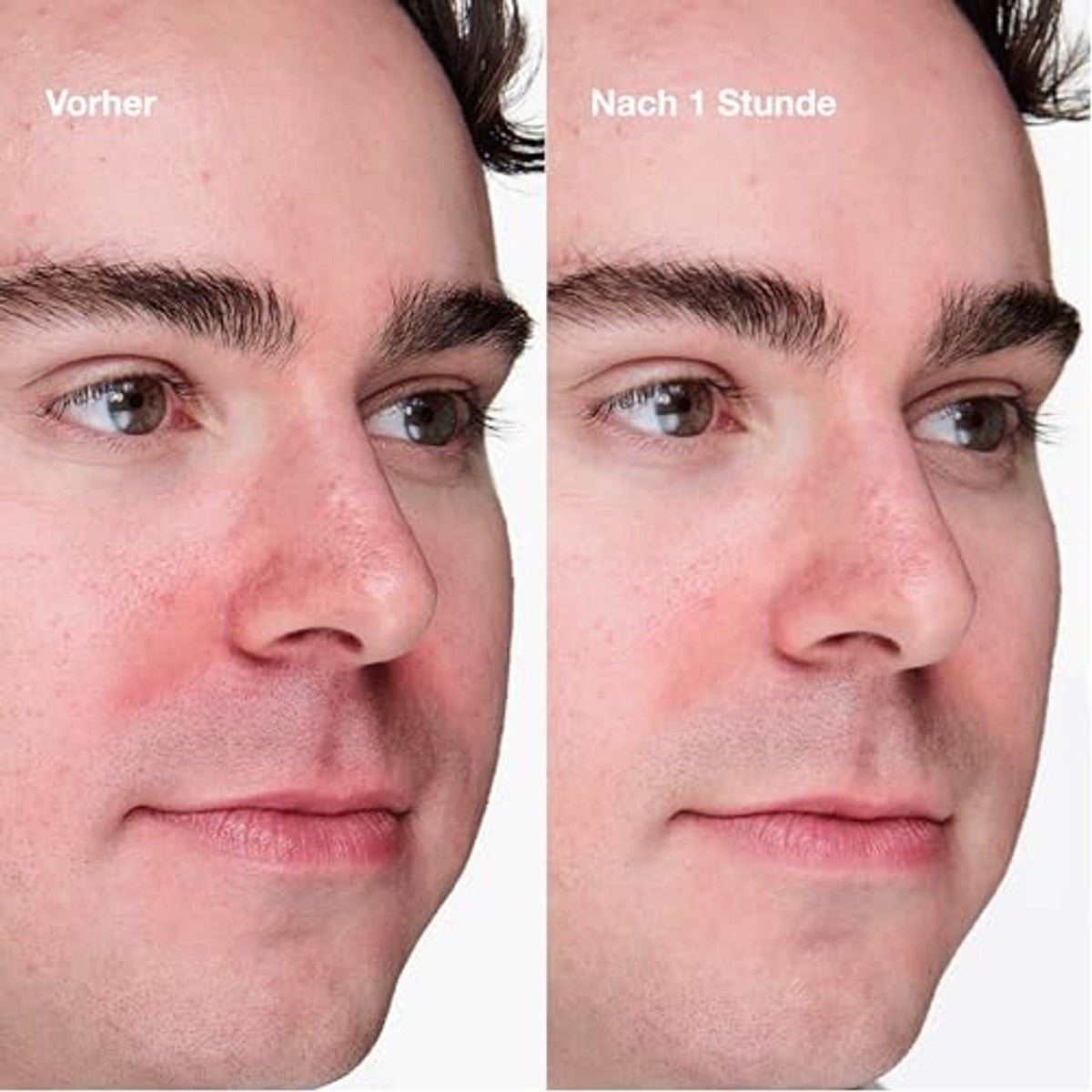 Clinique Anti-Blemish Solutions Clinical™ Advanced Clearing Gel, gezichtsgel met 2% salicylzuur, vermindert onzuiverheden, 20 ml