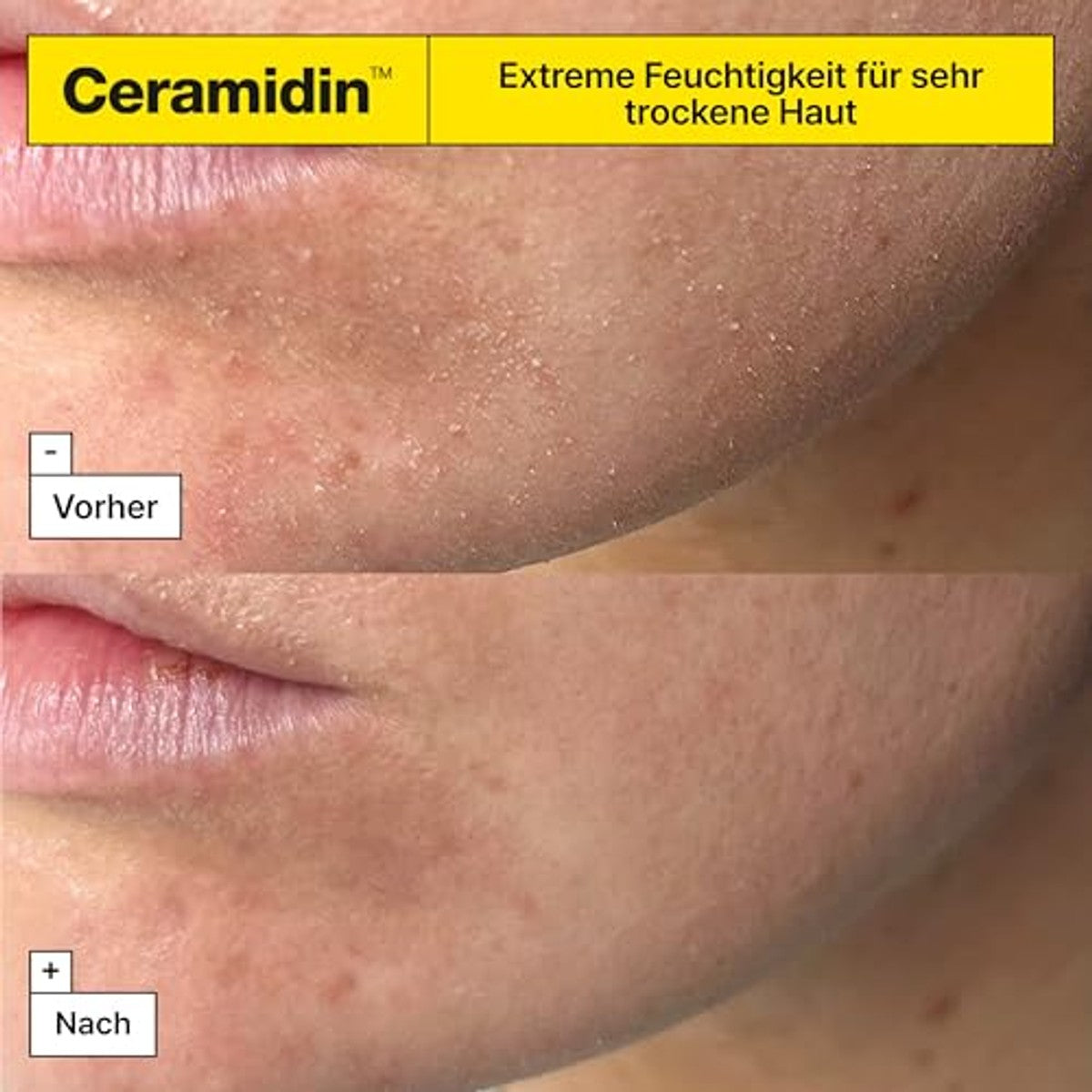 Dr. Jart+ Ceramidin Gezichtscrème 50 ml - 3-pack