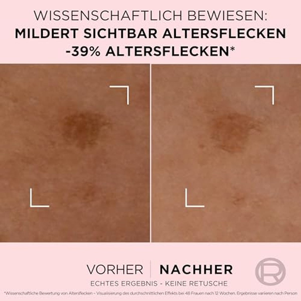 L'Oréal Paris Golden Age Rapid Corrector Serum 6 x 30 ml - Voordeelverpakking