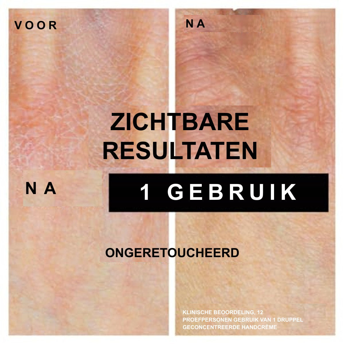 Neutrogena Direct Intrekkende Handcrème 6 x 75 ml