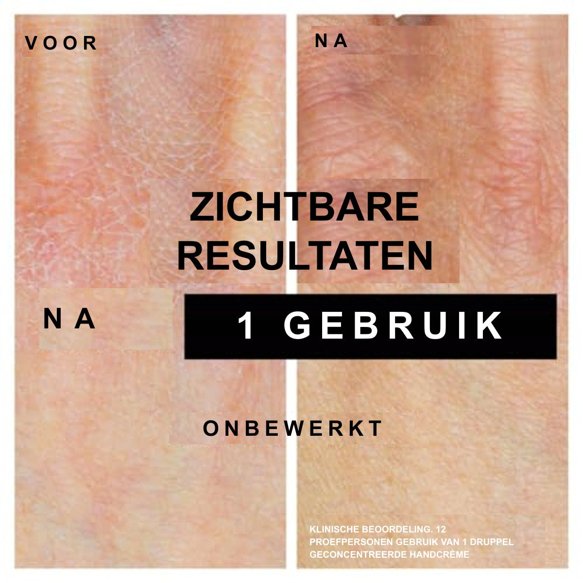 Neutrogena Geconcentreerde Ongeparfumeerde Handcrème 6 x 50 ml