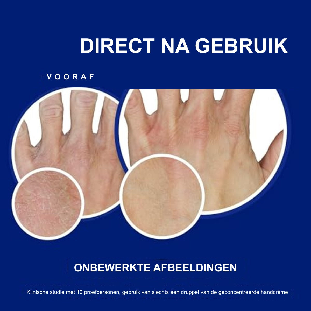 Neutrogena Onmiddellijk Intrekkende Handcrème 150 ml